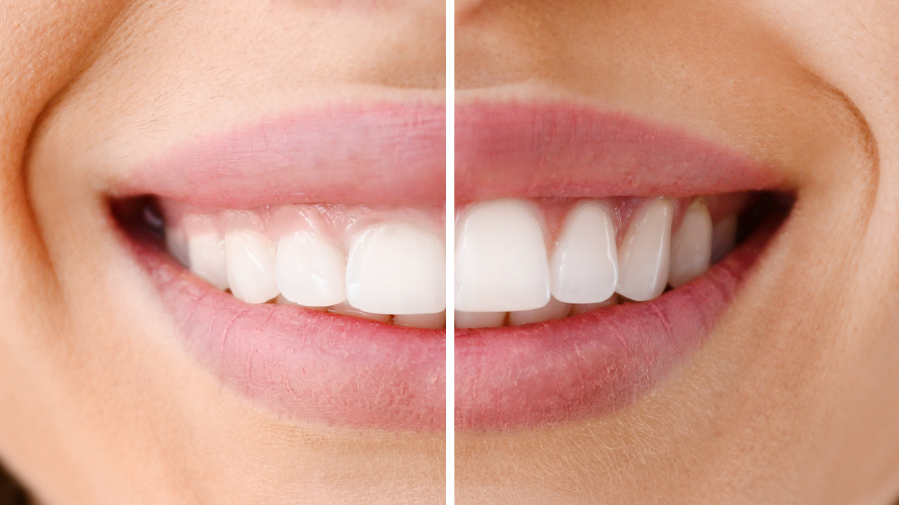 Cosmetic Dentistry Near Me: The Benefits Of A Great Smile