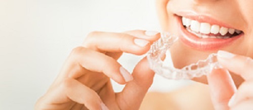 invisalign Surrey