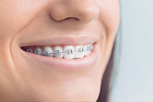 When Is Early Orthodontic Treatment Necessary?