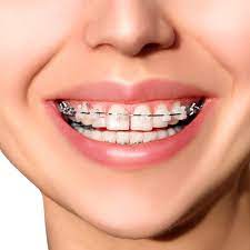 What are the Main Phases of Orthodontic Treatment?