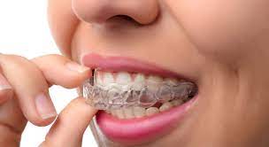 teeth braces for adults in Roanoke